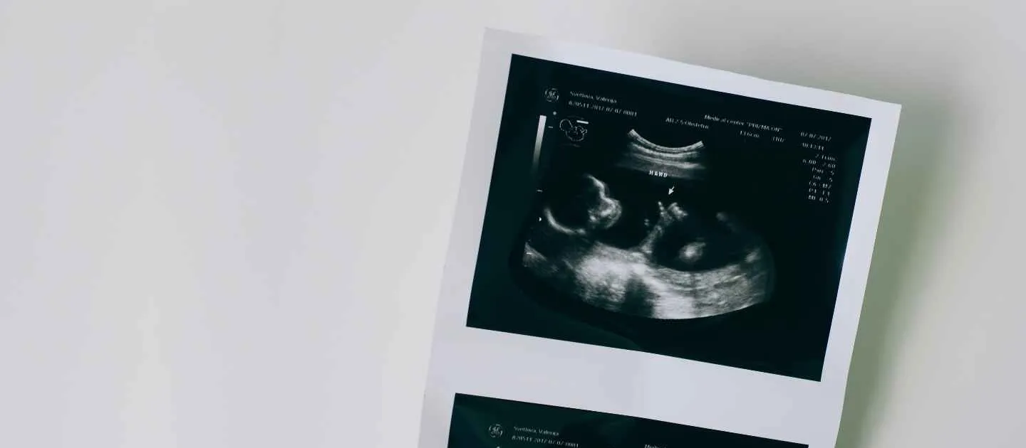 Ultrasound of newborn baby