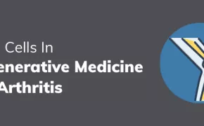 Stem Cells In Regenerative Medicine For Arthritis