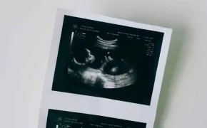 Ultrasound of newborn baby